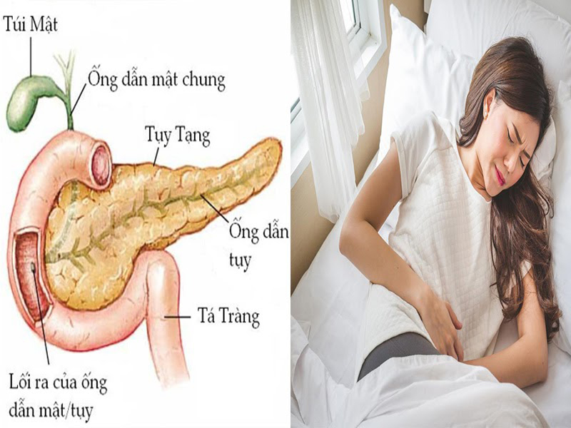 Viêm tụy gây ra những cơn đau dữ dội từ vùng bụng lan ra sau lưng
